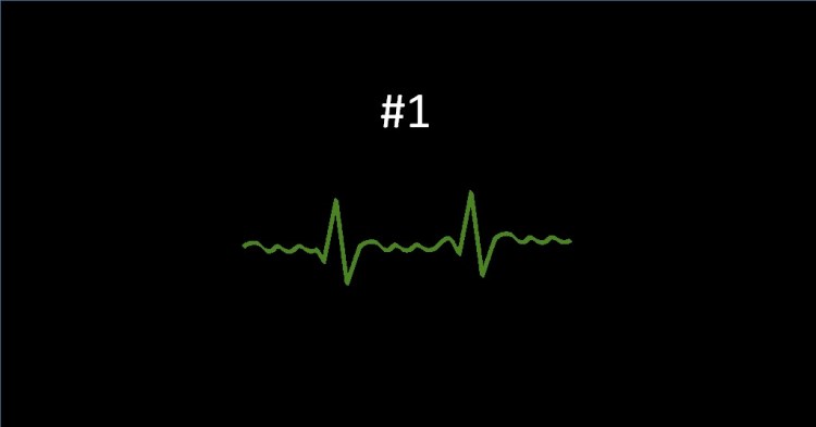 My first AFib Episode.