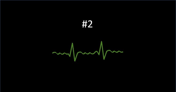 My second (misdiagnosed) AFib Episode